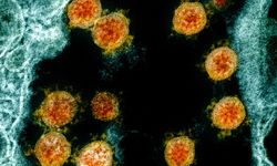 Çin’de ortaya çıkan gizemli virüs Avrupa’ya sıçradı
