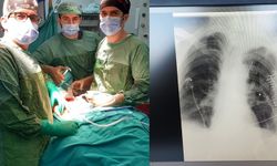 Bingöl Devlet Hastanesinde ilk kez 'Kaburga Fiksasyonu' ameliyatı yapıldı