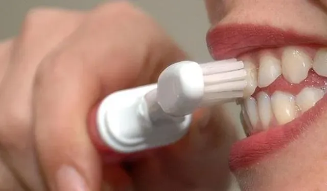 Diş Beyazlatma Kitleri Sağlığınızı Tehdit Edebilir