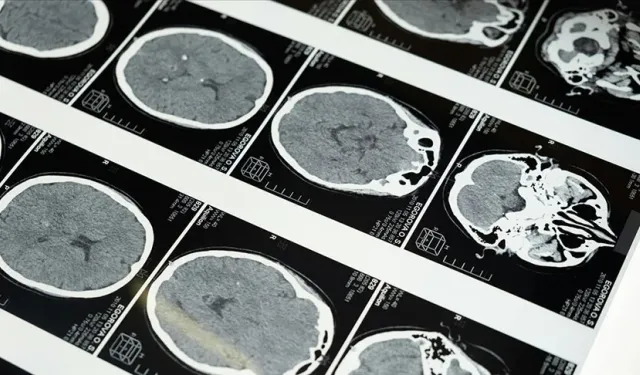 İnsan Beyninin Çarpıcı Portresi: Fransa'da Dev MRI Görüntüleme Atılımı!