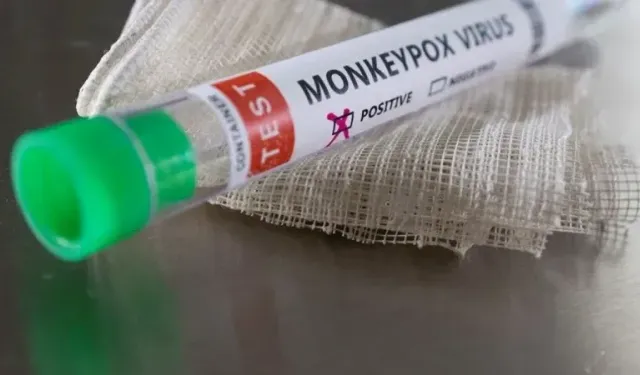 DSÖ'den Afrika'da artan Mpox vakalarına karşı uyardı